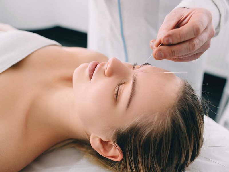 acupunctuur-behandeling-zhi-cheng acupunctuur-behandeling-zhi-cheng