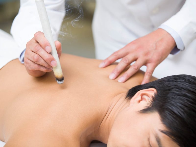 Zhi Cheng Praktijk Rotterdam Moxa Behandeling